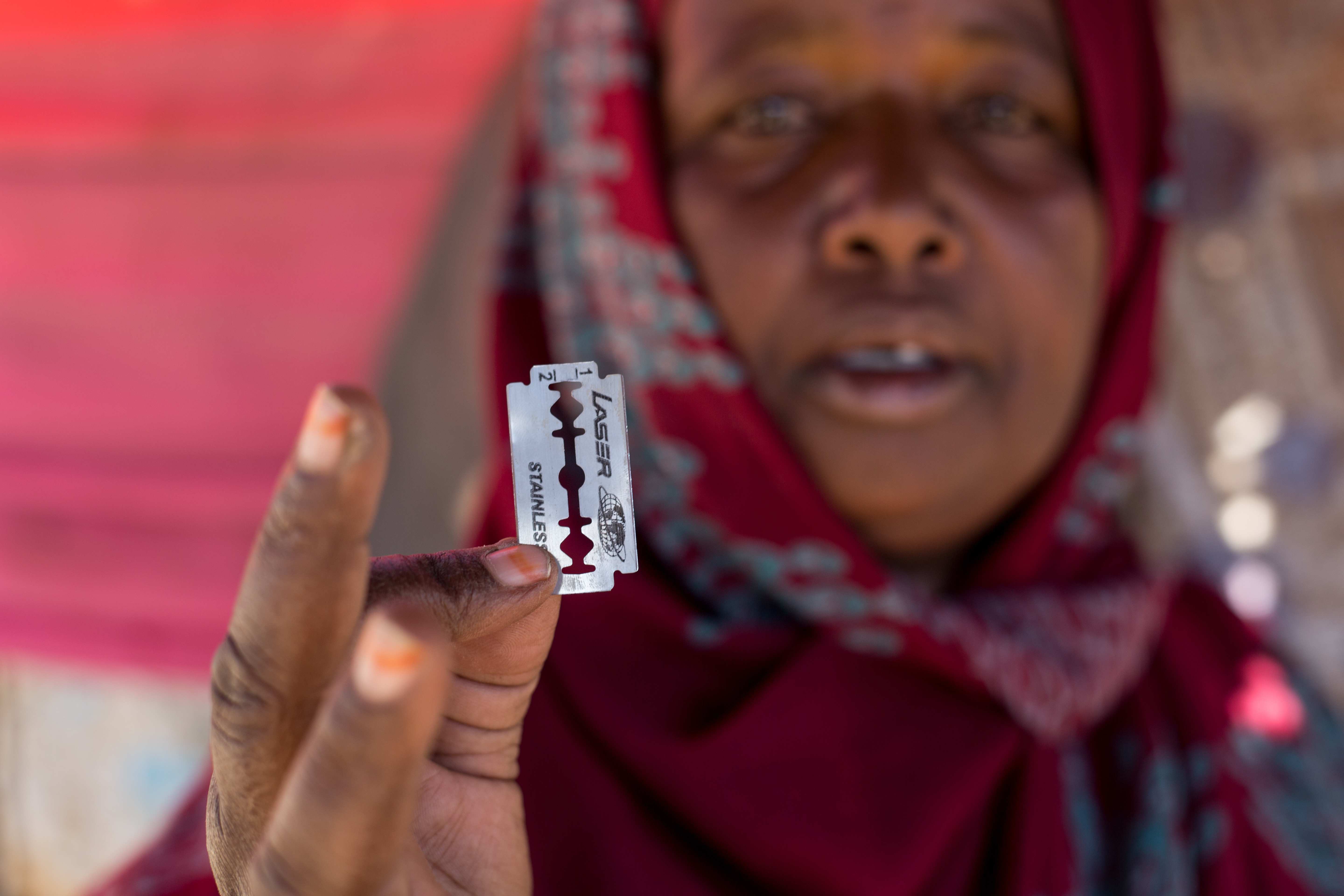 Nicht selten kommen bei der weiblichen Genitalverstümmelung Rasierklingen zum Einsatz (Foto: Kindernothilfe/Fairpicture)